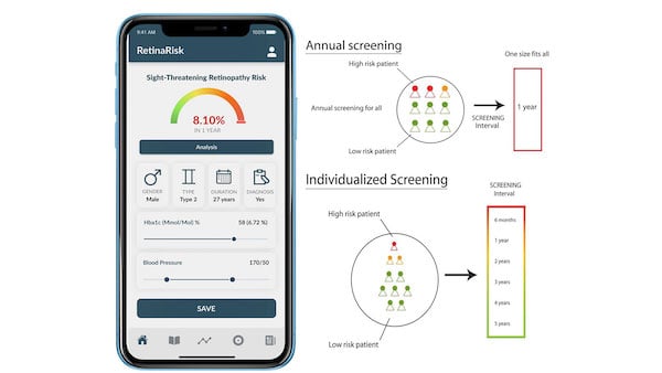 RetinaRisk app